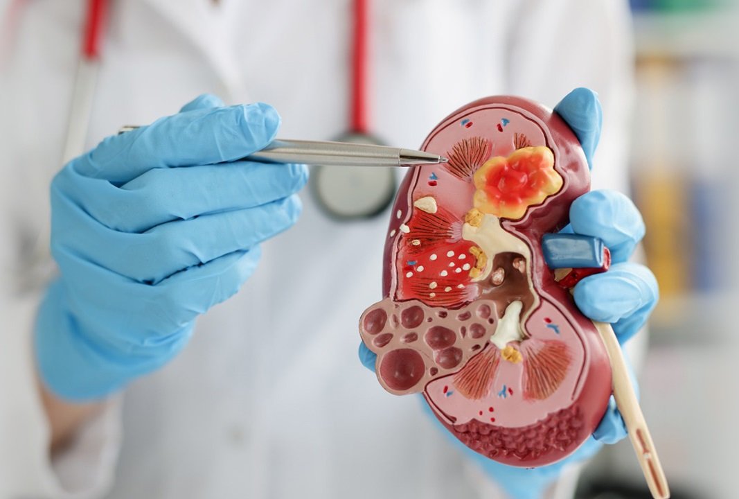 Kidney Test