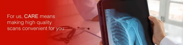 Lung Perfusion Scan