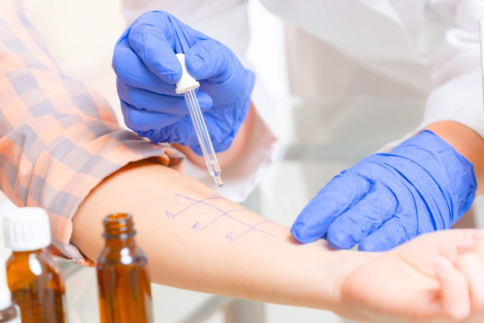 Allergy Test