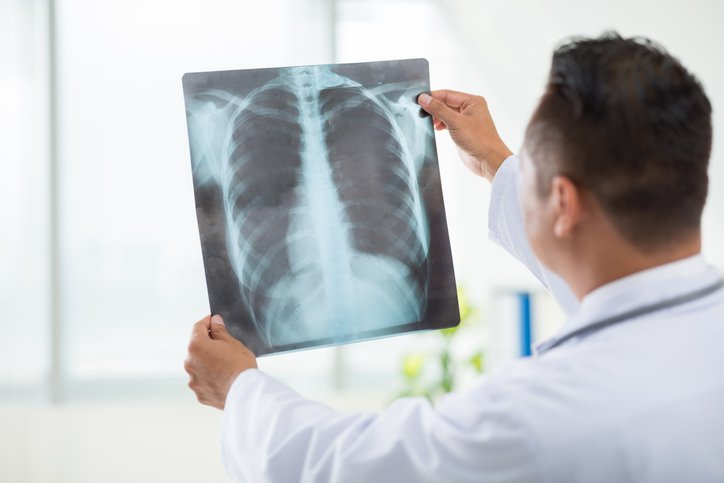 Xray